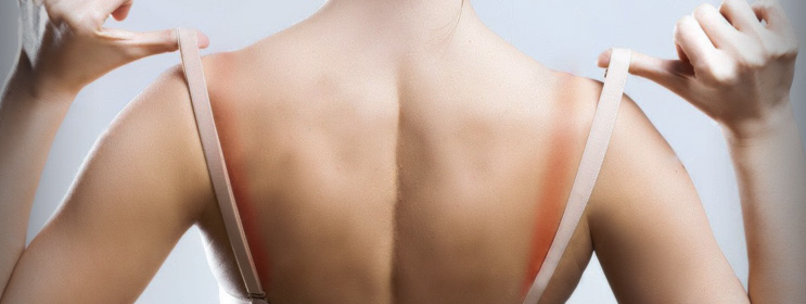 Bra Strap Syndrome could be behind that chronic pain